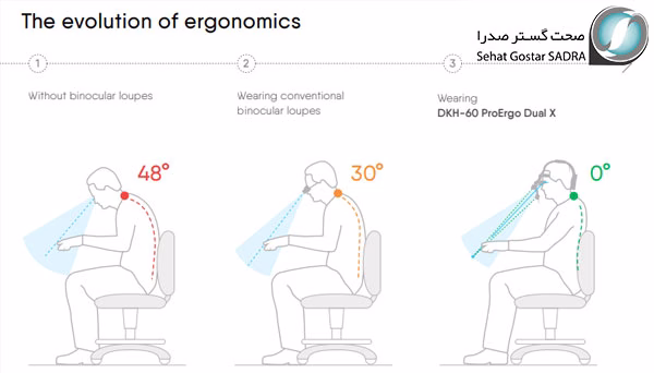مزایای کلیدی استفاده از لوپ ارگونومیک